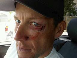 Tour de Californie : Armstrong Out !